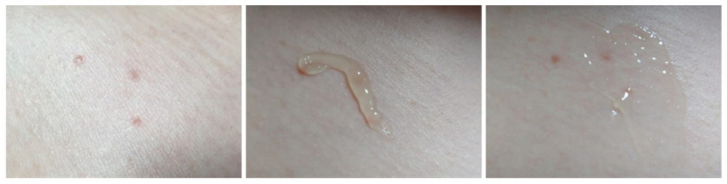 Using Spot gel