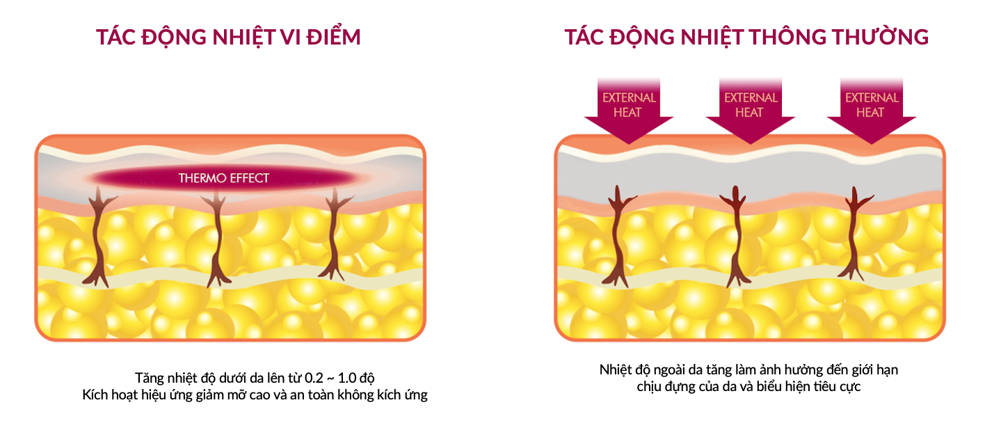 Vela Thermal Effect